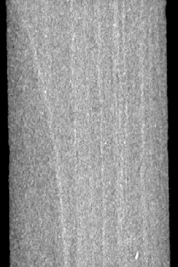 Longitudinal CT section